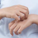 Почему чешутся руки: возможные причины и решения