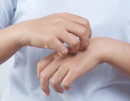 Почему чешутся руки: возможные причины и решения