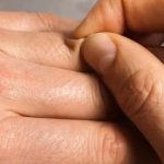Як визначити зневоднення організму