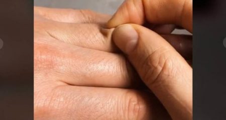 Як визначити зневоднення організму