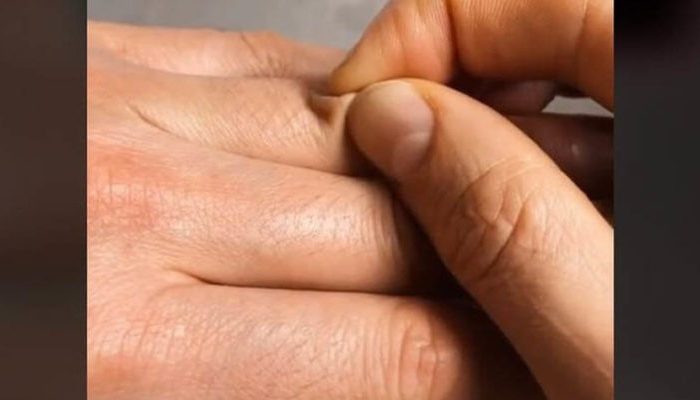 Як визначити зневоднення організму