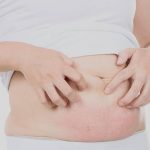Почему чешется живот и когда стоит обратиться к врачу
