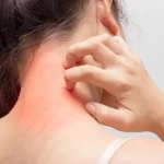 Почему зудит кожа: основные причины и способы устранения