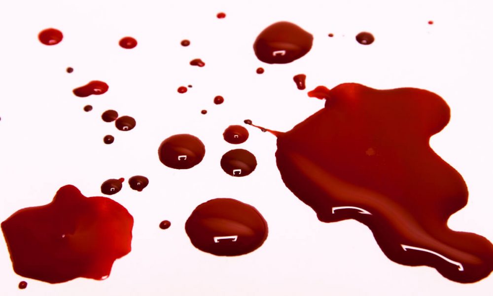 К чему снится кровь: толкование тревожного сна